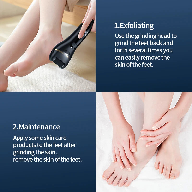 Electric Foot Grinder - Rechargeable USB Callus Remover with Adjustable Speed | Professional Pedicure Tool