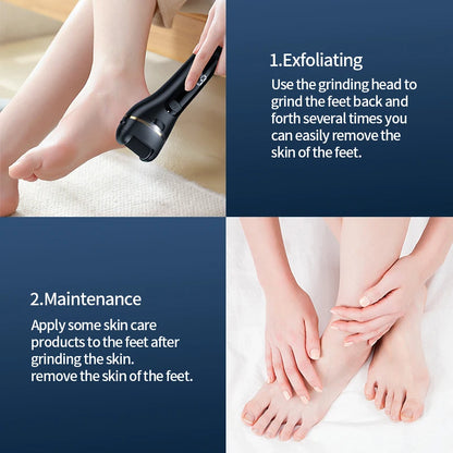 Electric Foot Grinder - Rechargeable USB Callus Remover with Adjustable Speed | Professional Pedicure Tool