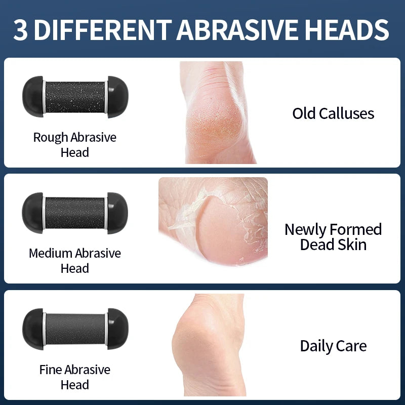 Electric Foot Grinder - Rechargeable USB Callus Remover with Adjustable Speed | Professional Pedicure Tool